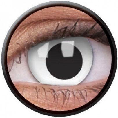 Kontaktlinsen schielendes Auge